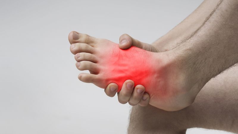 triệu chứng thường gặp Viêm cân gan chân